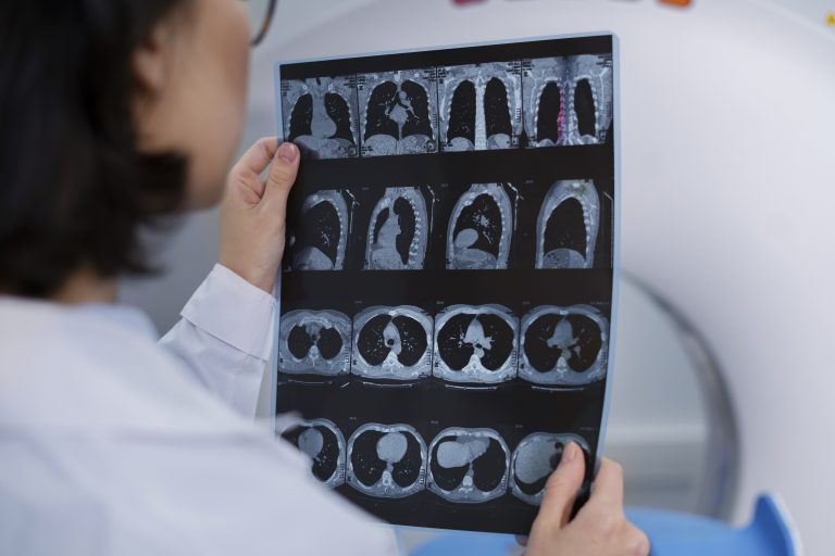 How to Find Affordable CT Scans in Houston | Nextgen Diagnostics