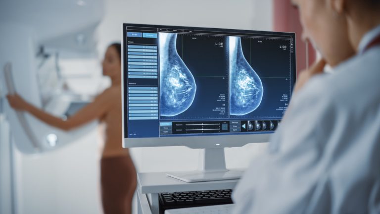 What Is A 3D Mammogram, And How Does It Work?