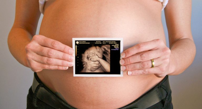 How Accurate Is 3D Ultrasound For Pregnancy?
