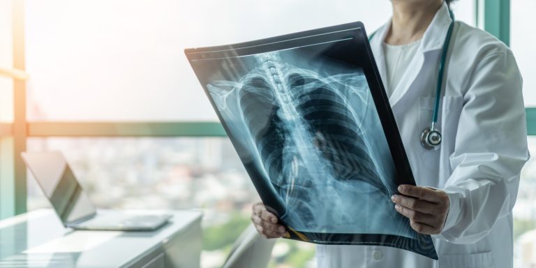 Is It Safe To Choose A Low-Cost X-Ray Provider in Houston?