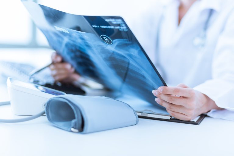 Where Can You Find Affordable X-Ray Services in Houston?