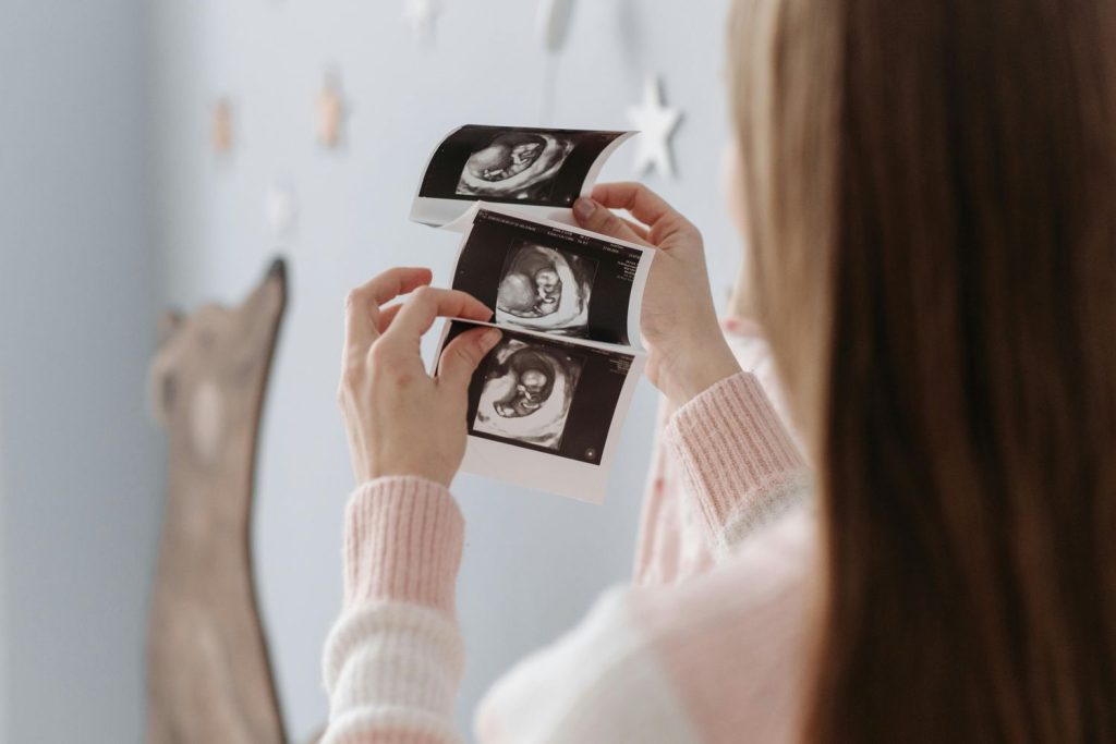 A pregnant woman holds her baby's ultrasound photos, a happy result of a walk-in ultrasound in Houston.