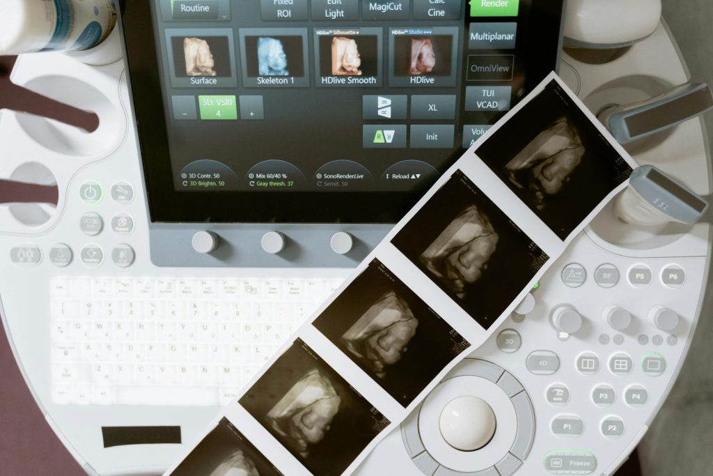 High-tech equipment displays a detailed 3D ultrasound, typical of premium medical imaging centers in Houston.