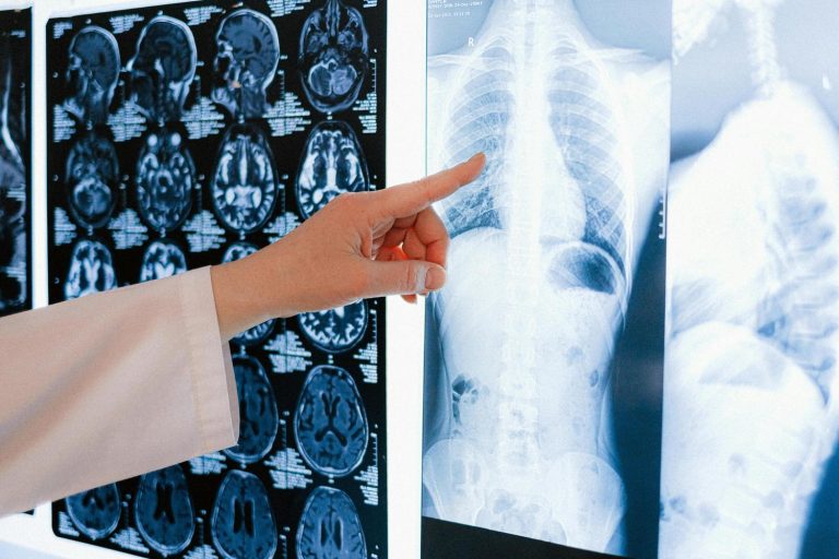 A medical professional points to various X-rays and CT scans available at premier imaging centers in Houston.