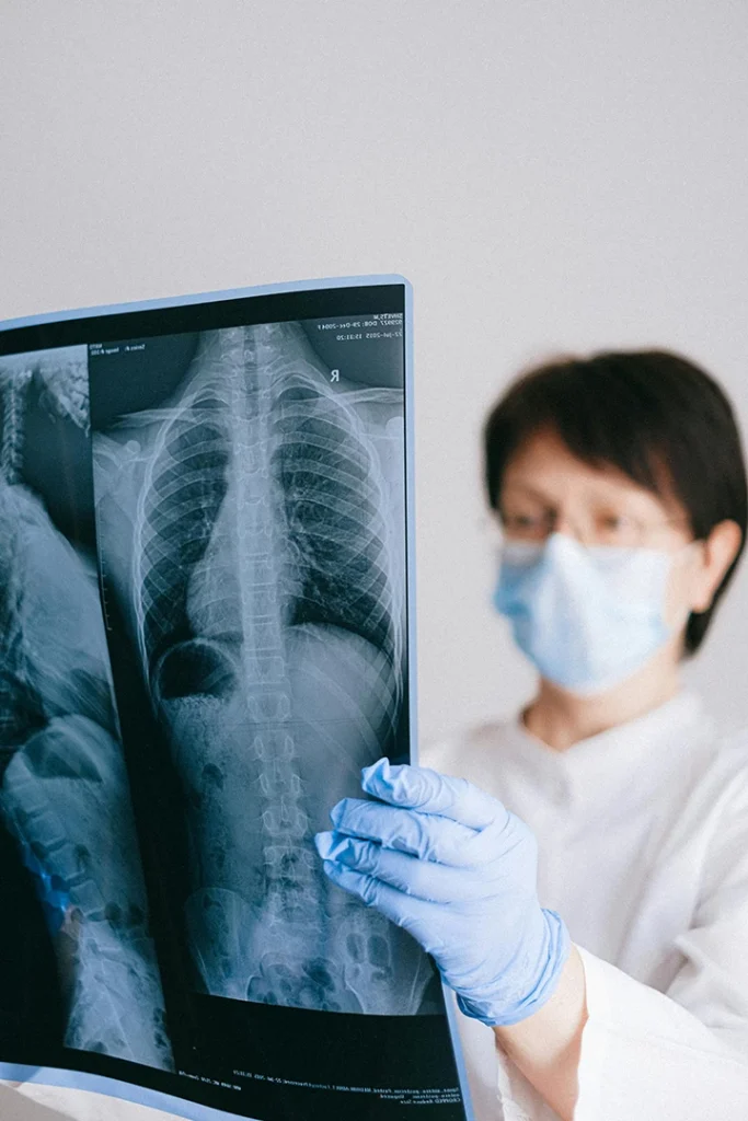 Gloved doctor examining detailed chest and spine X-ray at a cheap X-ray Houston clinic, focusing on diagnostic film for precise medical assessment.