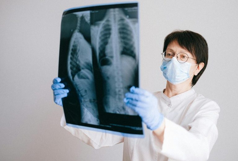 Radiologist reviews chest film during x ray services Houston. Protective gear and dual-view scan shown in clinical setting.
