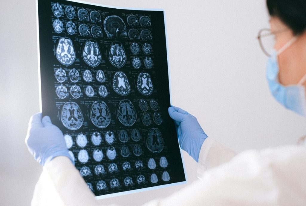 Medical expert examines brain MRI results after cheap CT scan in Houston for neurological assessment and treatment.