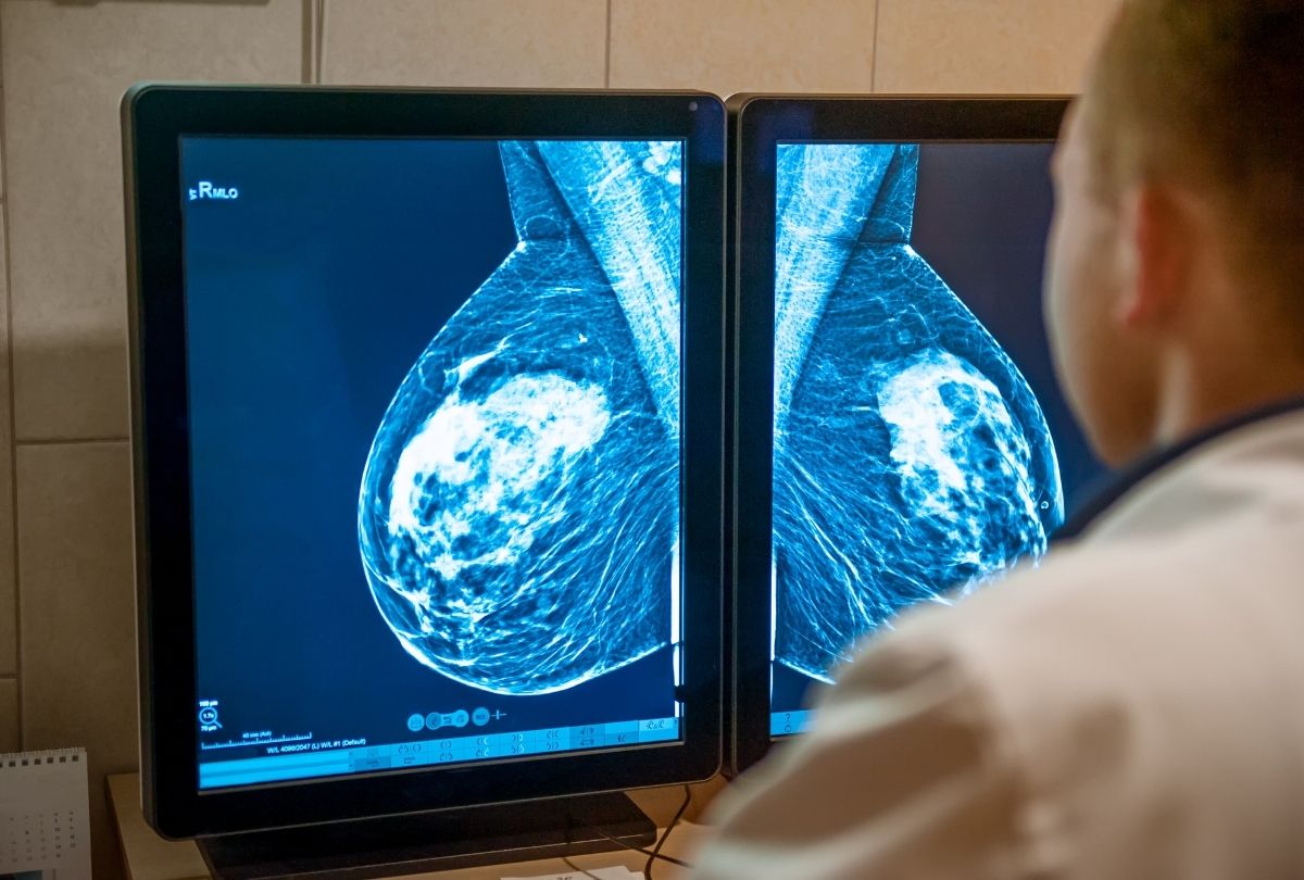 Radiologist reviews 3D Mammograms Houston scans for early breast cancer detection using advanced imaging technology