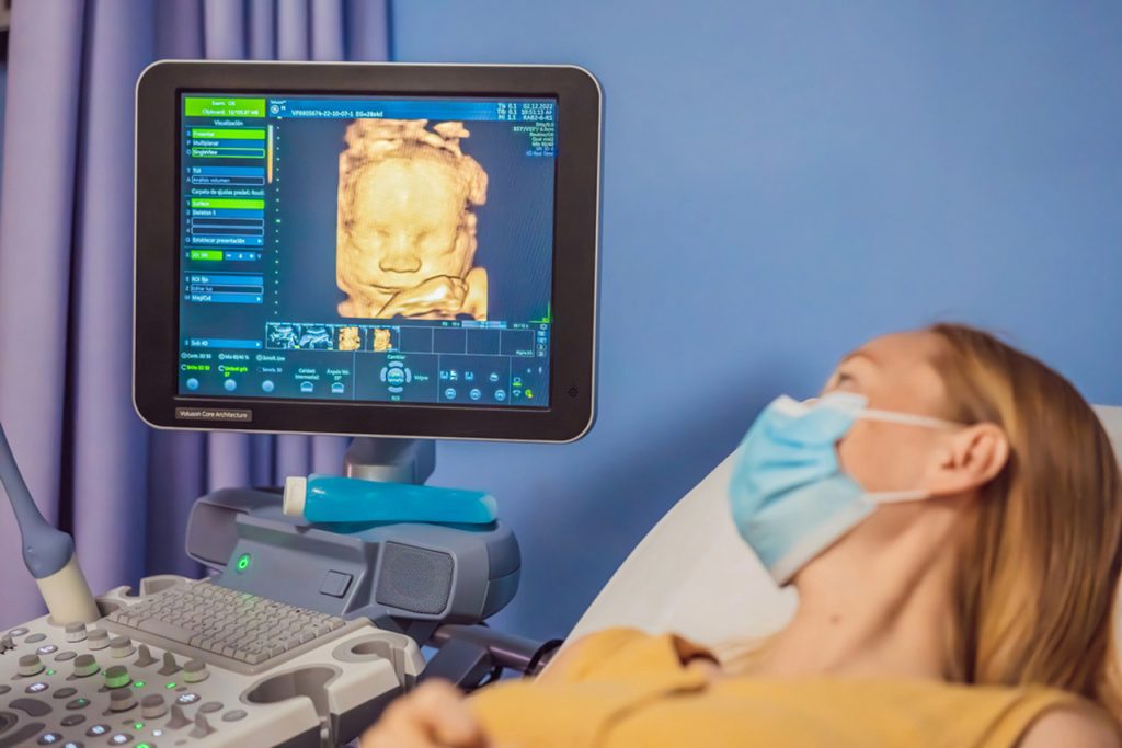 3D ultrasound Houston clinic showing detailed baby scan on screen while pregnant patient lies on exam bed during prenatal imaging