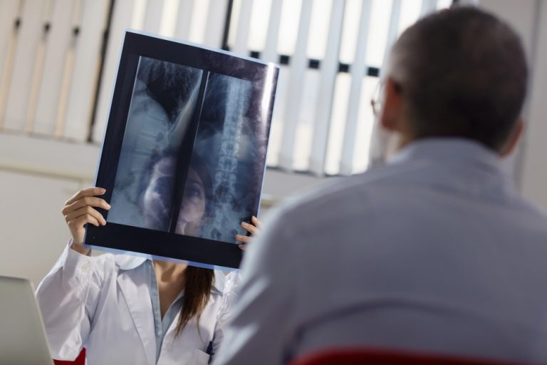 Doctor holding up spine X-ray film while consulting with patient in office, personalized care through professional X-ray services Houston.