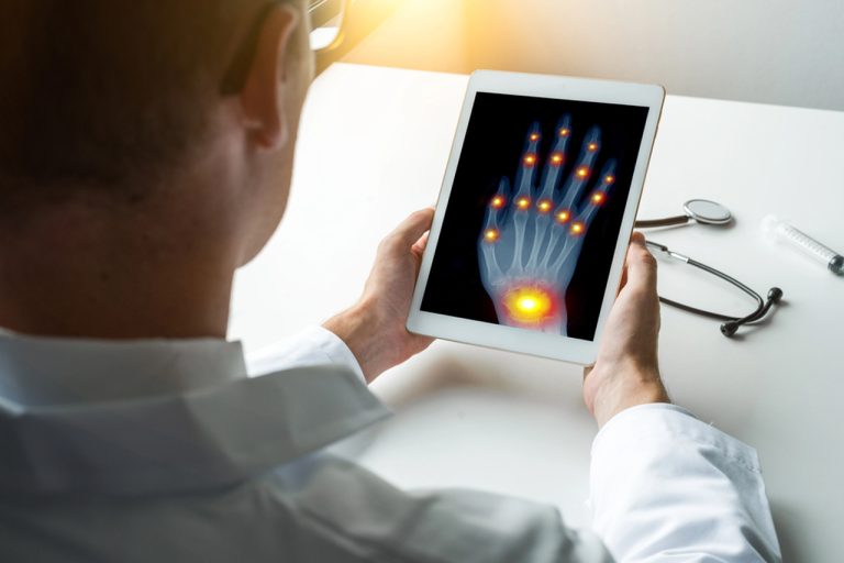 Doctor viewing digital hand X-ray with highlighted inflammation on tablet for quick walk-in X-ray services in Houston clinic.