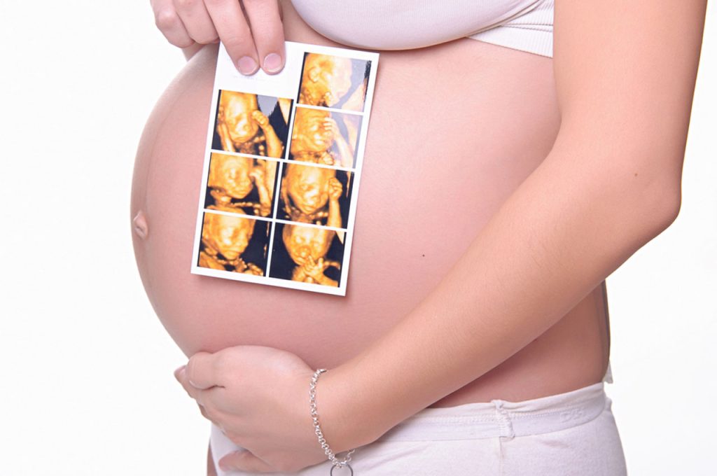 Expecting mother holding 3d ultrasound Houston fetal images over baby bump during advanced prenatal screening and maternity care visit