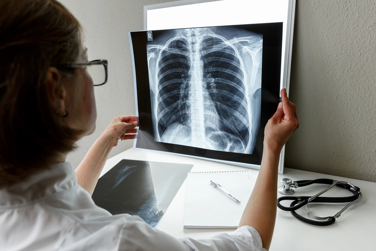 Female physician examining chest X-ray film on lightbox during diagnostic review at walk-in X-ray facility in Houston.