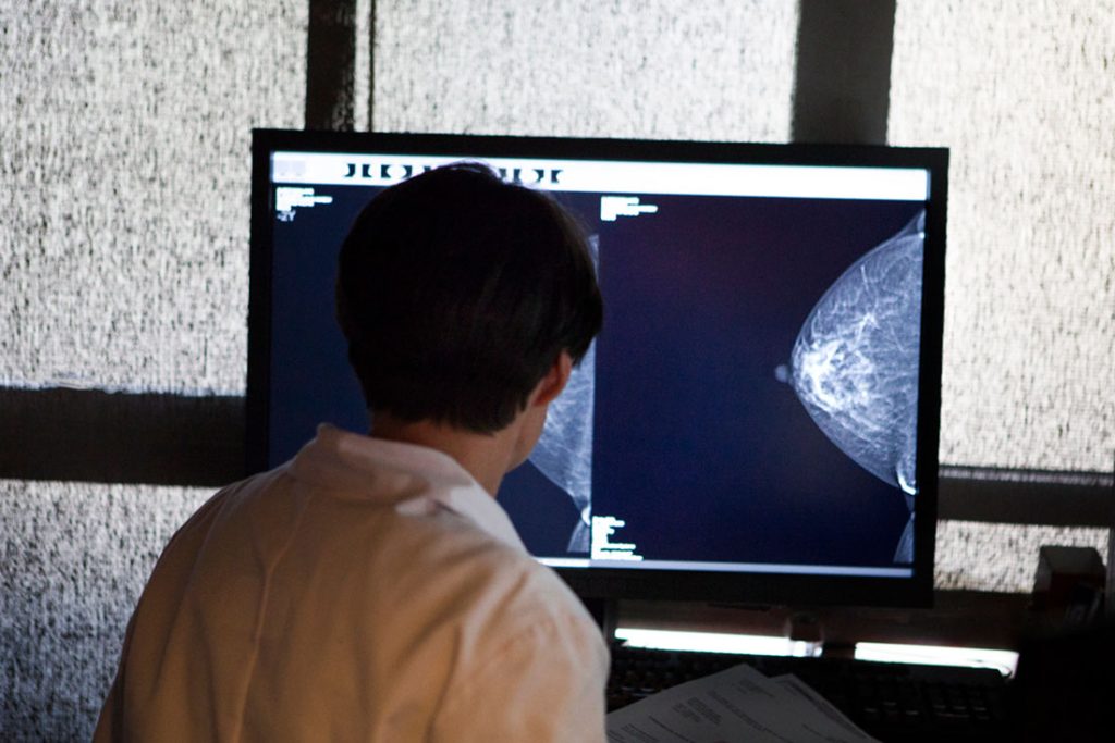 Radiologist reviewing walk-in mammograms in Houston on computer monitor, analyzing breast X-ray images for accurate diagnosis.