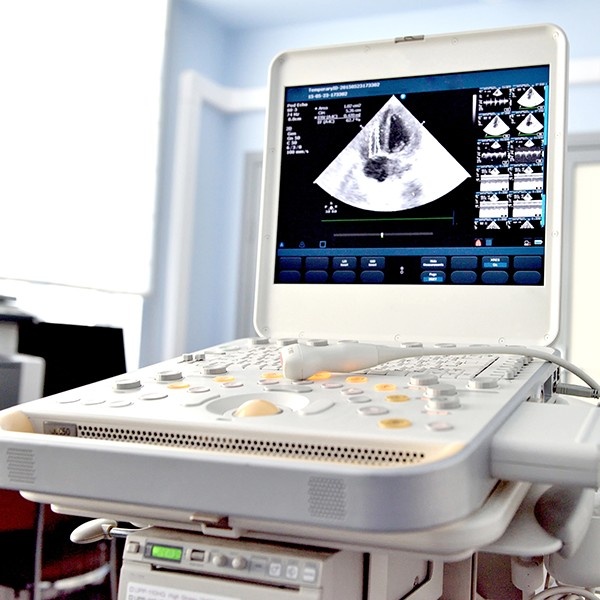 Advanced ultrasound machine at NextGen Scans Houston