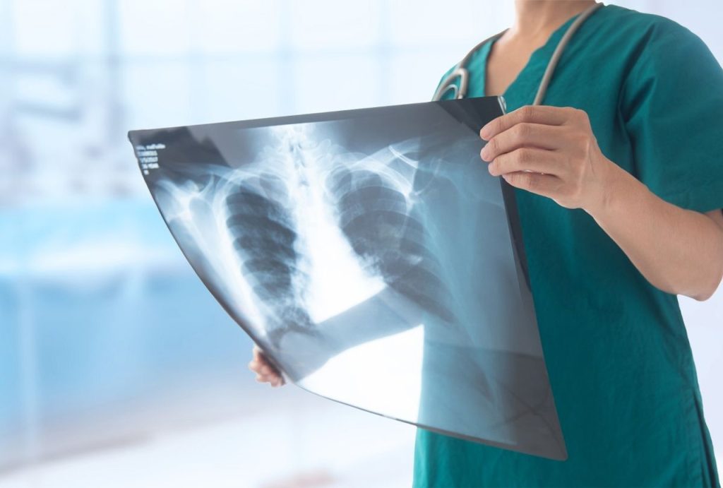Doctor in green scrubs holding chest X-ray film for review, offering immediate walk in X Ray services in Houston at trusted urgent care clinic.