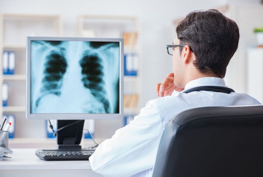 Physician analyzing chest X-ray on computer monitor, providing fast and accurate walk in X Ray Houston for quick diagnosis and treatment.