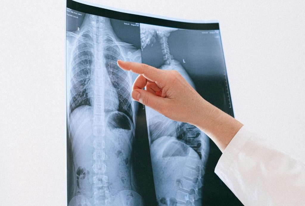 Physician studying lung X-ray on computer monitor in clinic, providing efficient walk in X Ray Houston options for fast and reliable health assessments.