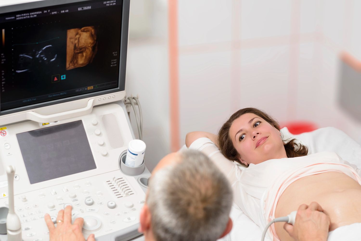A pregnant woman lying in a clinic while a sonographer performs a 3D ultrasound in Houston, with the monitor displaying a detailed 3D image of the fetus.