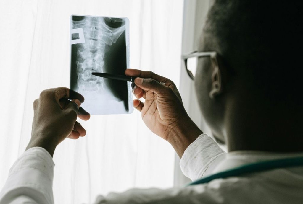 Radiologist pointing to spine X-ray film with pen, explaining results during walk in X Ray Houston appointment at professional medical facility.