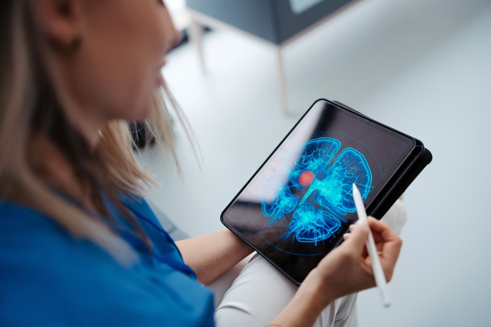 A doctor points a stylus at a brain scan on a tablet to review results from cheap ct scans in Houston.