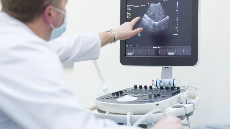 A doctor points to an abdominal scan on a monitor during a cheap ultrasound houston consultation for a patient.