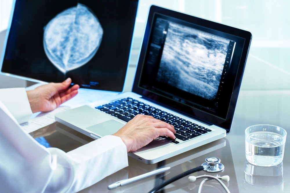 Houston radiologist reviews a physical mammogram film and ultrasound on a laptop, discussing 3D mammograms results.