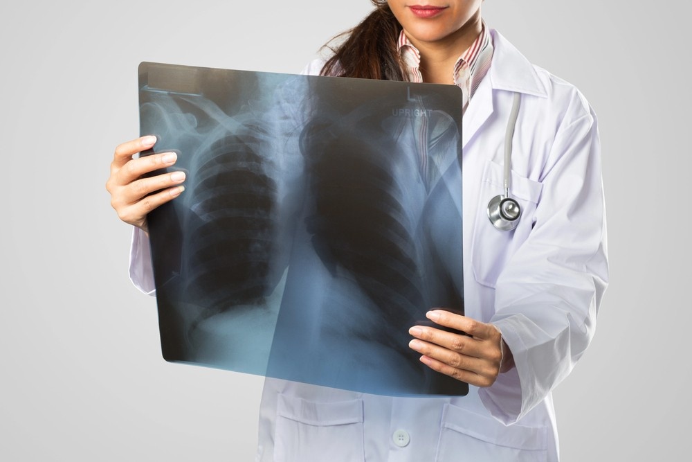 A doctor carefully examines a chest X-ray film, checking for lung health. This is a crucial step in the diagnosis. Professional x-ray services houston.