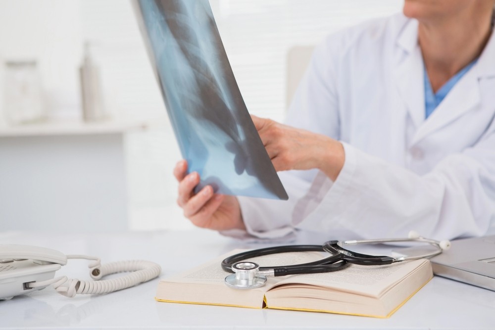 A doctor's hands hold and point to a chest X-ray film for analysis. Stethoscope on a book. Quality x-ray services houston.